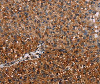 NMT2 Antibody