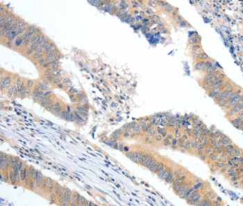 APOB Antibody