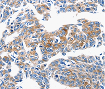 CCL6 Antibody
