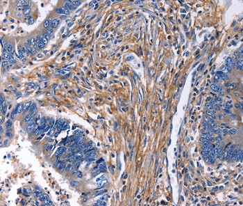 CXCR5 Antibody
