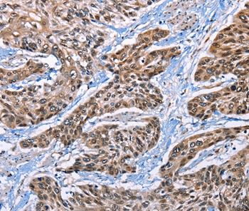 EPHA4 Antibody