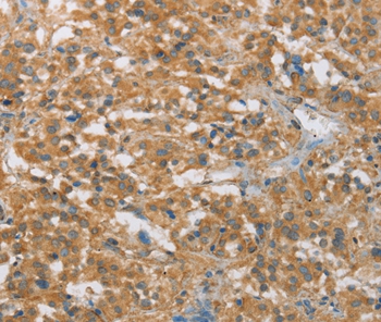 FASLG Antibody