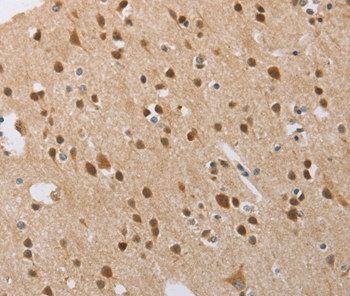 FASLG Antibody