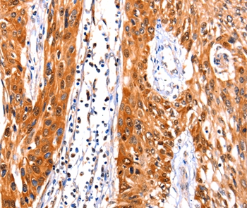 FBLN1 Antibody