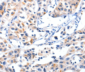FBLN5 Antibody