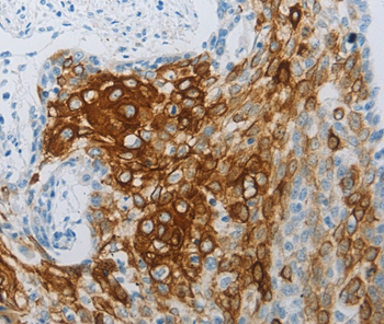 FLG Antibody
