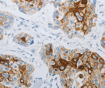 FLG Antibody