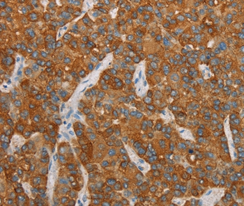 FOSB Antibody