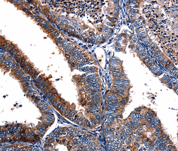 FPR2 Antibody