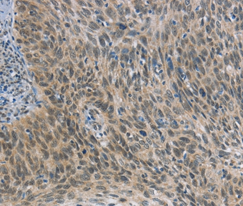 FOXF1 Antibody