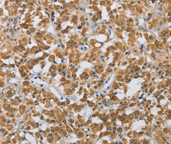 FOXF1 Antibody