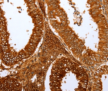 FOXN1  Antibody