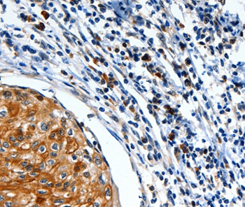 FOXO1  Antibody