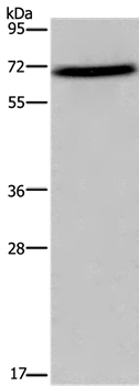 FOXO1  Antibody