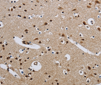 CMTM8 Antibody
