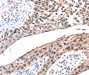 GJB2 Antibody