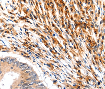 SLC2A5 Antibody