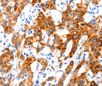 SLC2A11 Antibody