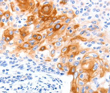 SLC2A11 Antibody