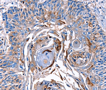 LRP2  Antibody