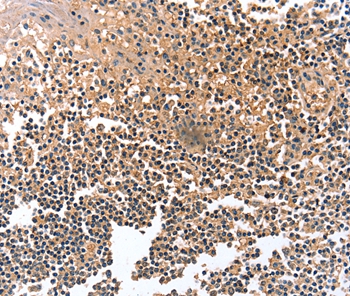 GRB10 Antibody
