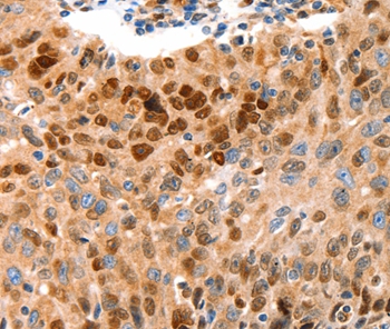 GRM4 Antibody