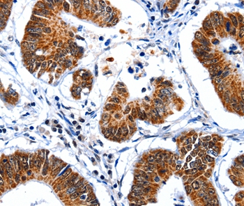 GSK3A Antibody