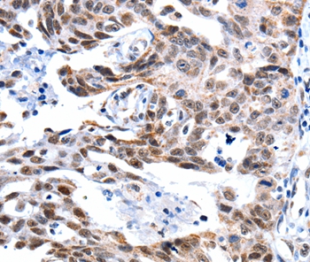 GSK3A Antibody