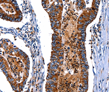 ITGA7 Antibody