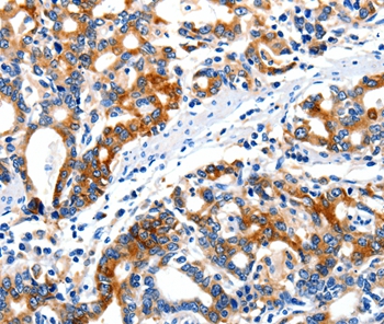 ITGAX Antibody