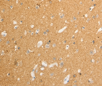 ATP1A1 Antibody