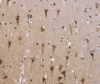 ABCB1 Antibody