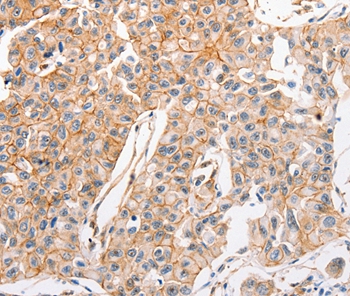 ABCC1 Antibody
