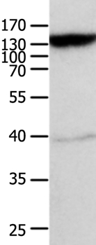 ABCC5 Antibody