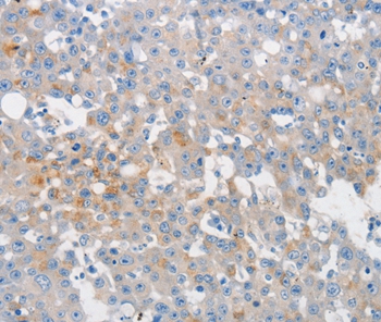 MUC5AC Antibody