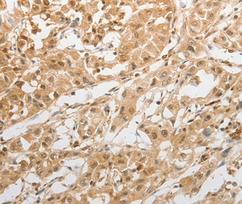 GRIN2C Antibody