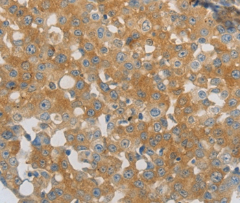 PPAP2A Antibody