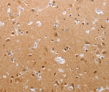 PFN2 Antibody