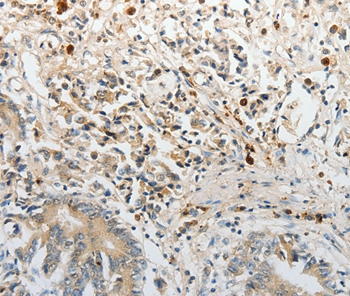 PTTG2 Antibody