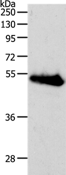 RBMS3 Antibody