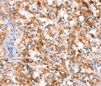 SPRN Antibody