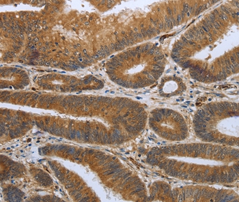 SHBG Antibody