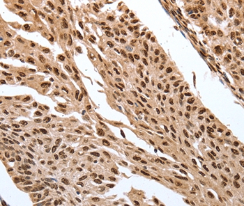 SRF Antibody