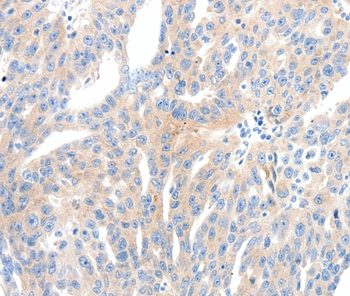 NFATC2 Antibody