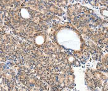 NFATC2 Antibody