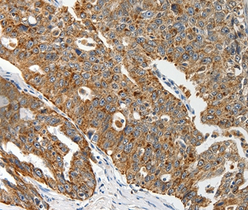 ABCD2 Antibody