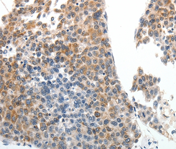 ABCG5 Antibody