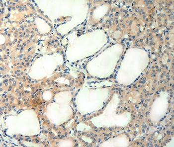 AGRN Antibody