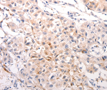 KRT6B Antibody