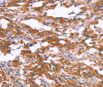RPS6KA6 Antibody